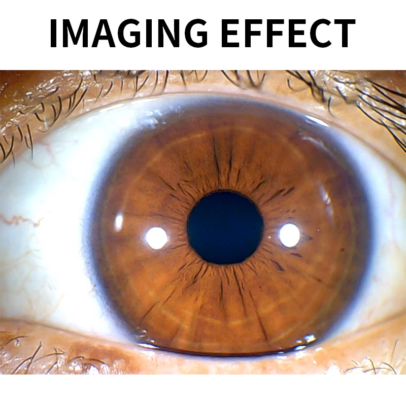 Cámara ocular multifunción profesional de 12 MP, escáner de iridología, Detector de Iris Digital