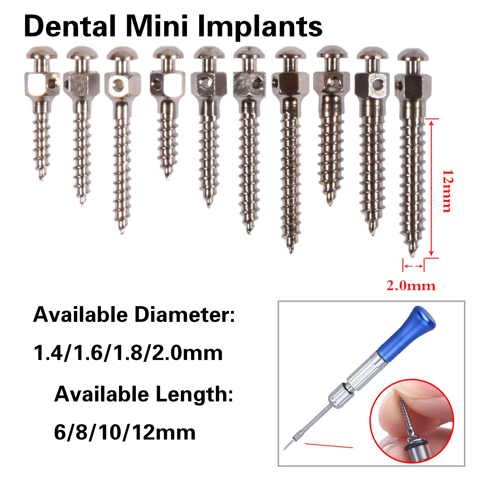 

Стоматологические инструменты 10,0 размеров, ортодонтические принадлежности, якорные гвозди различного диаметра, съемная ручка, отвертка, гаечный ключ, набор ключей