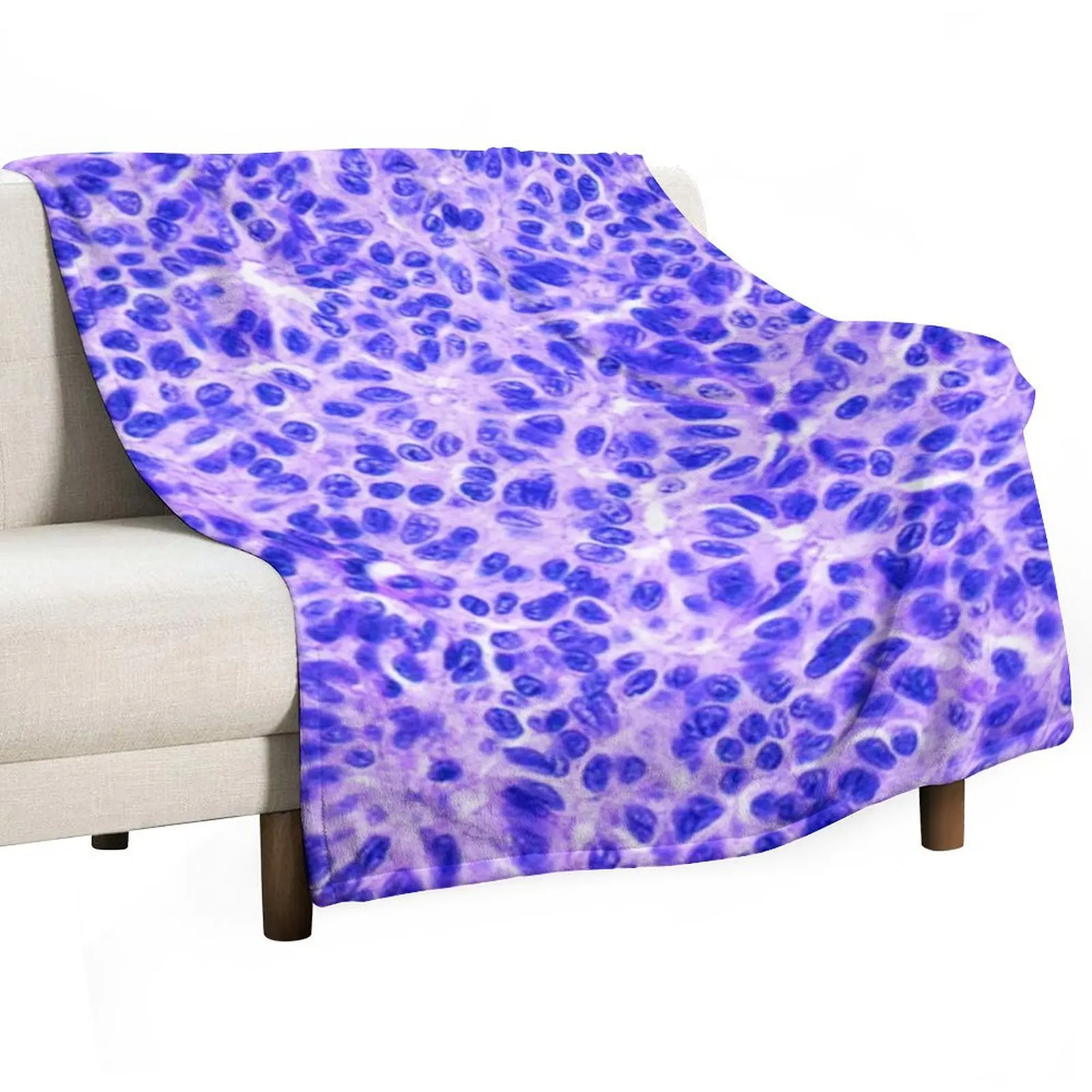 Ovarian Dysgerminomas Throw Blanket Picnic Decorative Sofa Travel Blankets