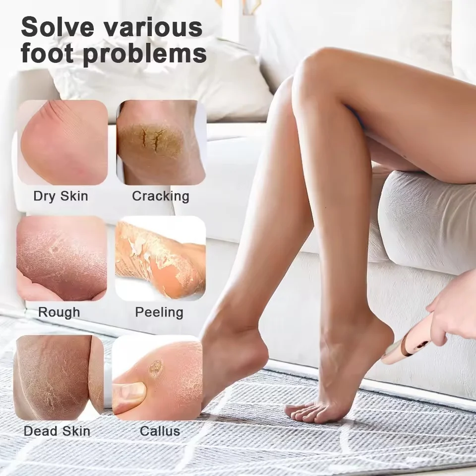Wireless Electric Foot Callus Remover Machine Rechargeable Pedicure Tool for Dead Skin And Cuticle Removal with Replacement Sand