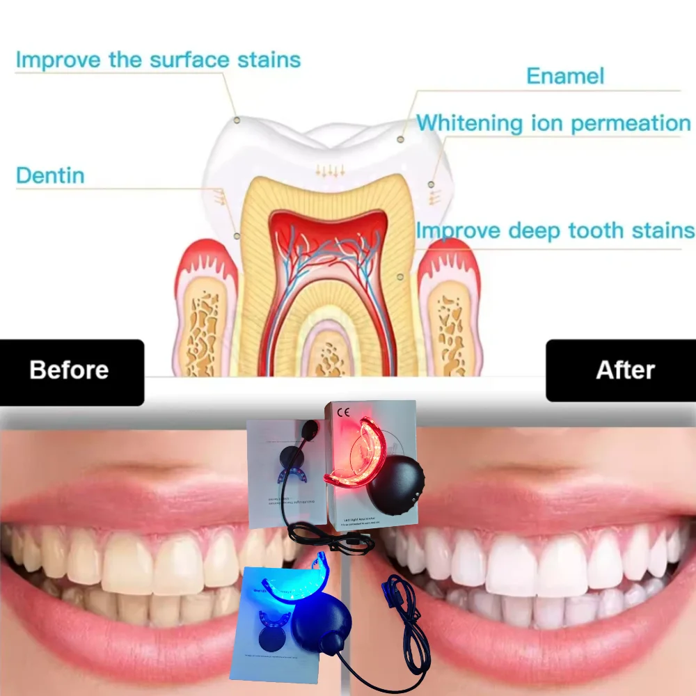 Portable Red and Blue Light Oral Device, for Immediate Tooth Pain Gum Sensitivity Relief Therapy