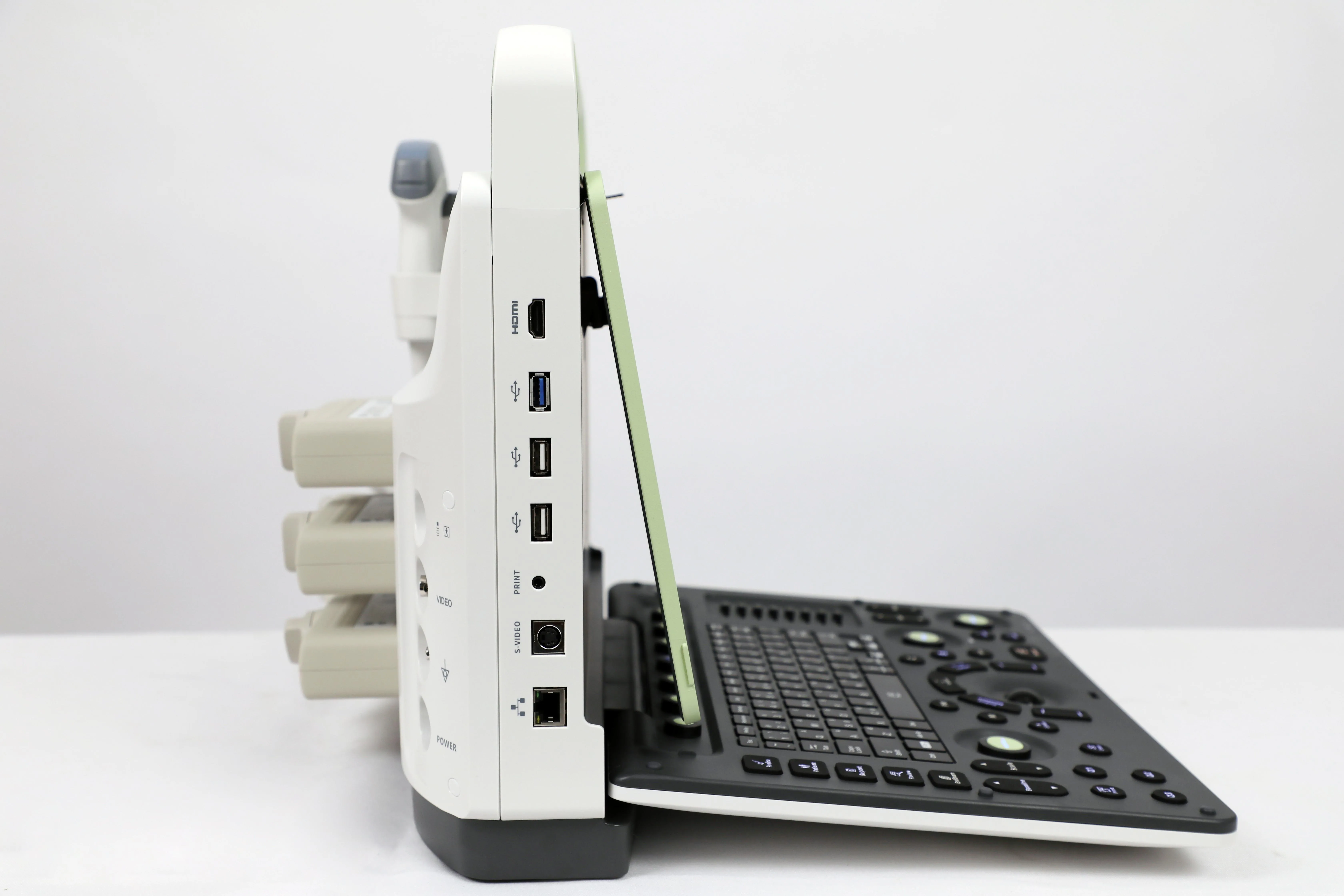 Рисунок 3 - Ультразвуковой ультразвуковой аппарат