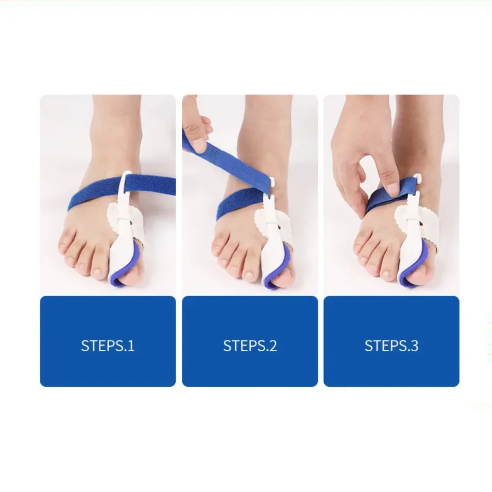 Corrector de Halux Valgus para dedos de los pies, separador de juanetes, separador de juanetes, 2 piezas