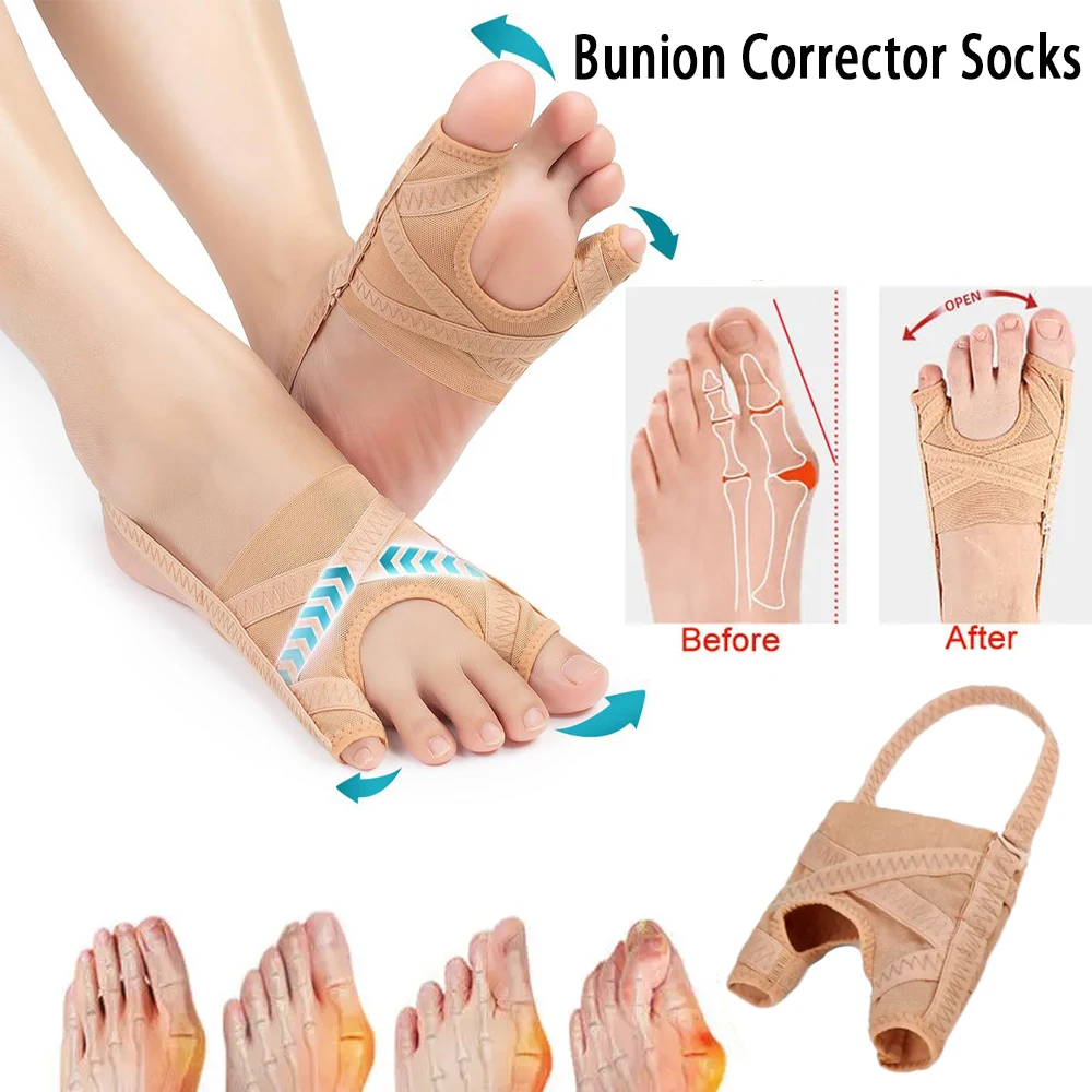 Fabric Bunion Corrector Breathable Adjustable Hallux Valgus Sleeve Spacer Separator Toe Corrector Sports Bunion Socks Running