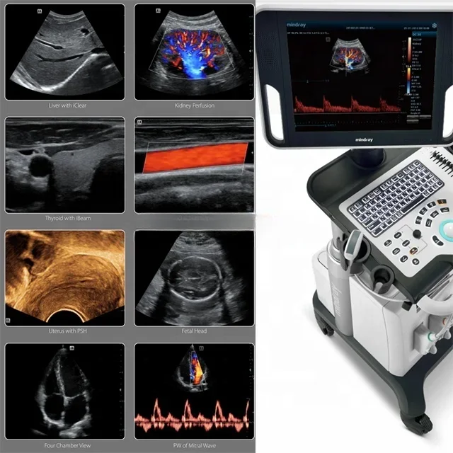 ultrasound Trolley Color Doppler Ultrasound  Machine