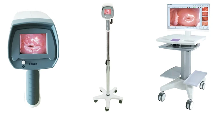 LED Video Display Electronic Colposcope for Gynecology