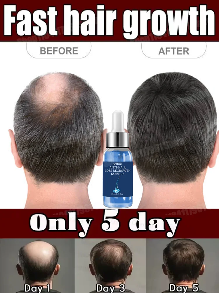 

Essential для роста волос OiI Say Goodbye to Baldness The Secret Of Thick Hair Growth Сыворотки стимулируют фолликулы для волос увлажняют