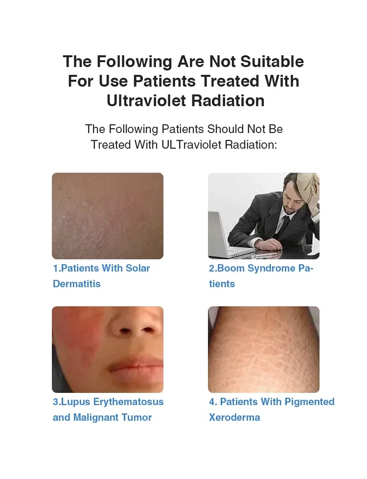 مصابيح الصدفية العلاجية بالضوء excimer 308 311nm لمصباح البهاق led 308nm uvb آلة العلاج بالضوء #5