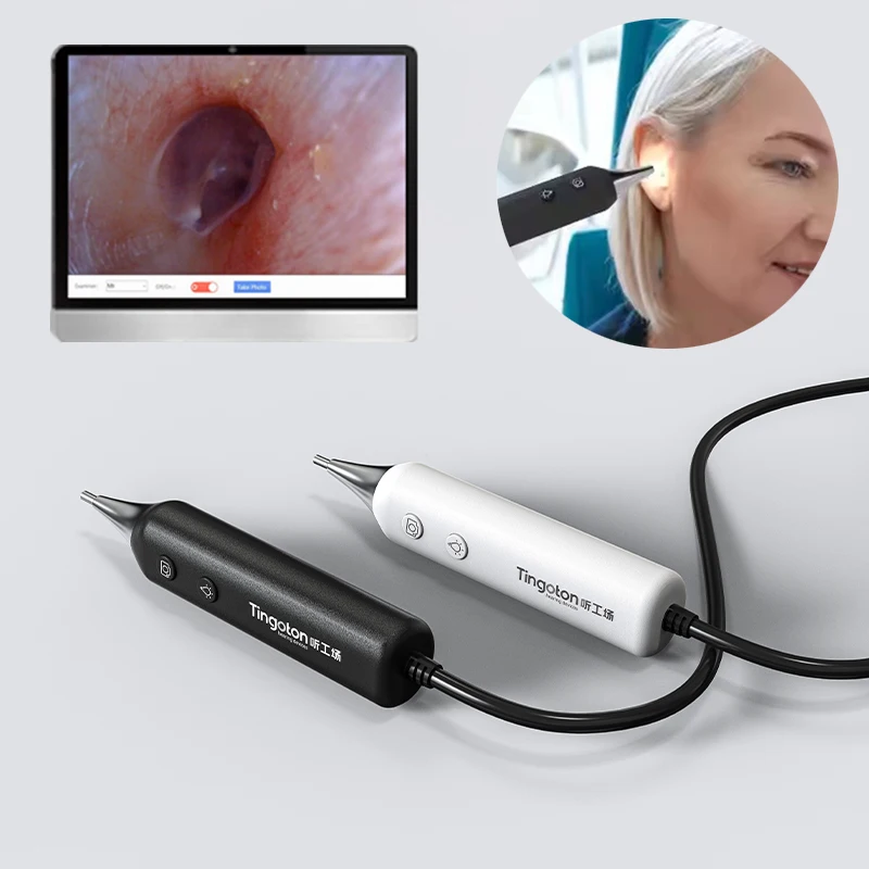 Handheld Digital Smart Otoscope Microscope Endoscope Inspection Camera Stand 1280x720 Resolution Adjustable LED Light