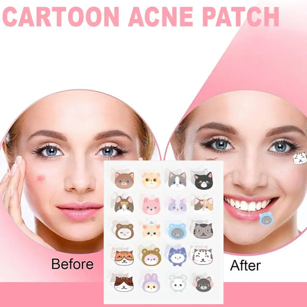 600/1400PCS Cartoon Star Acne Patches Concealer Pimple Patches Invisible ColorfuI Pimple Cover Sticker Pimple Removal