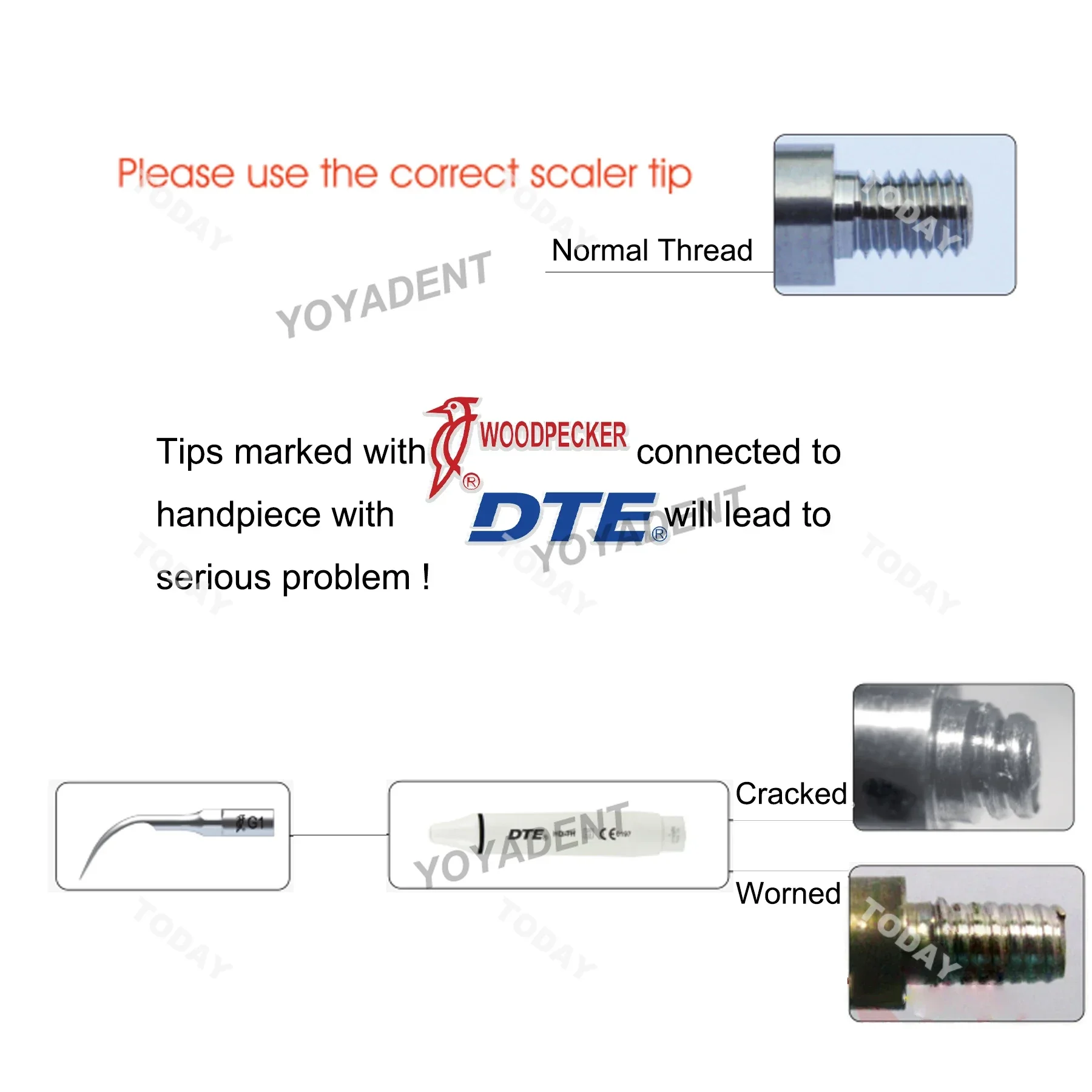 Woodpecker Dental Ultrasound Scaler Tips Cavity Preparation Scaling Tips SB1 SB2 SB3 Fit EMS UDS Ultrasonic Scaler Handpiece