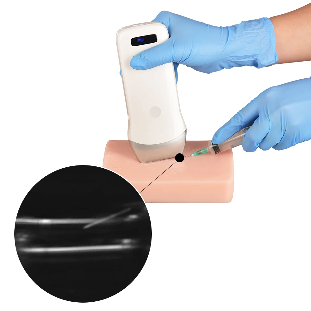 Ultrasound-guided Vascular Puncture Emulator Anatomical Model Human Body Model Medical Students Practice PlasticTPR Silicone PVC