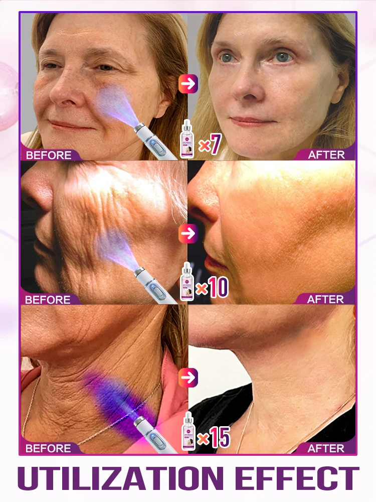 เครื่องมือดูแลผิวหน้า ชุดรวม อายุ 20 ปี ลดเลือนริ้วรอย จัดส่งฟรี