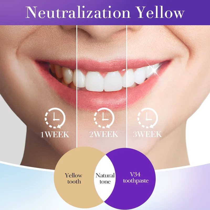 Whitening Toothpaste, Removes Tartar, Prevents Bad Breath, Maintains Oral Hygiene and Freshness, Suitable for Both Men and Women