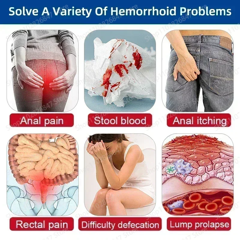 Best Sellers Hemorrhoid Remover Cream Removal Internal Natural Herbal Extract Relieve Anal Anus Swelling Bleeding treatment Gel