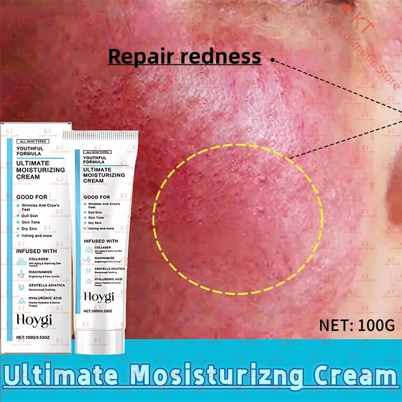 

Ultimate Moisturizing Cream Repair Redness Centella Asiatica Soothing Collagen Niacinamide Firming Brighten Face Skincare 100g