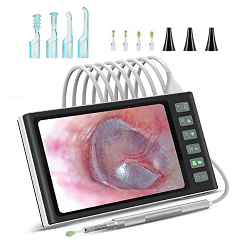 Digital Otoscope With 7-Inch Screen, Ear Camera, Visual Ear Scoop Supports Photo Snapshots And Video Recording,Ear Scoop Durable