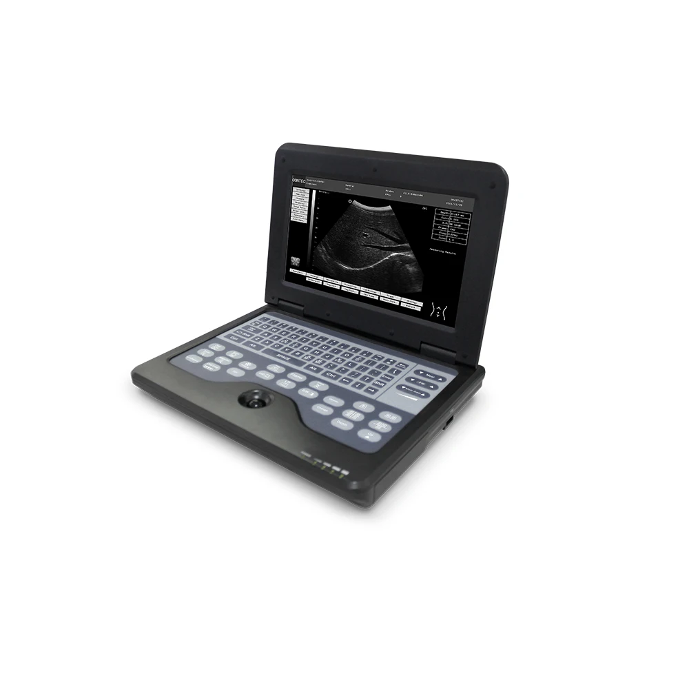 CMS600P2-VET 3d Laptop Vet Portable Medical Ultrasound Instruments Veterinary Scanner Machine B-Ultrasound Diagnostic System