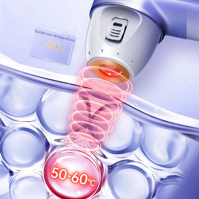 Home Use Mini i5 Ultrasonic Face Lifting Line Wrinkle Removal Anti-aging Device