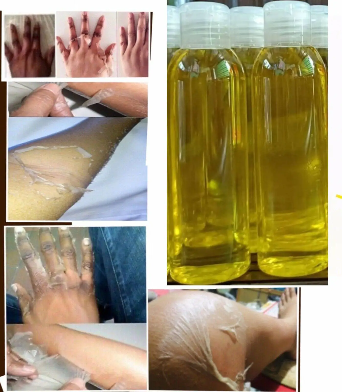 Yellow Peeling Oil Yellow Extra Strength Exfoliating Bleaching Dark Skin Retinol with Peptide Spots Blackheads Blemishes