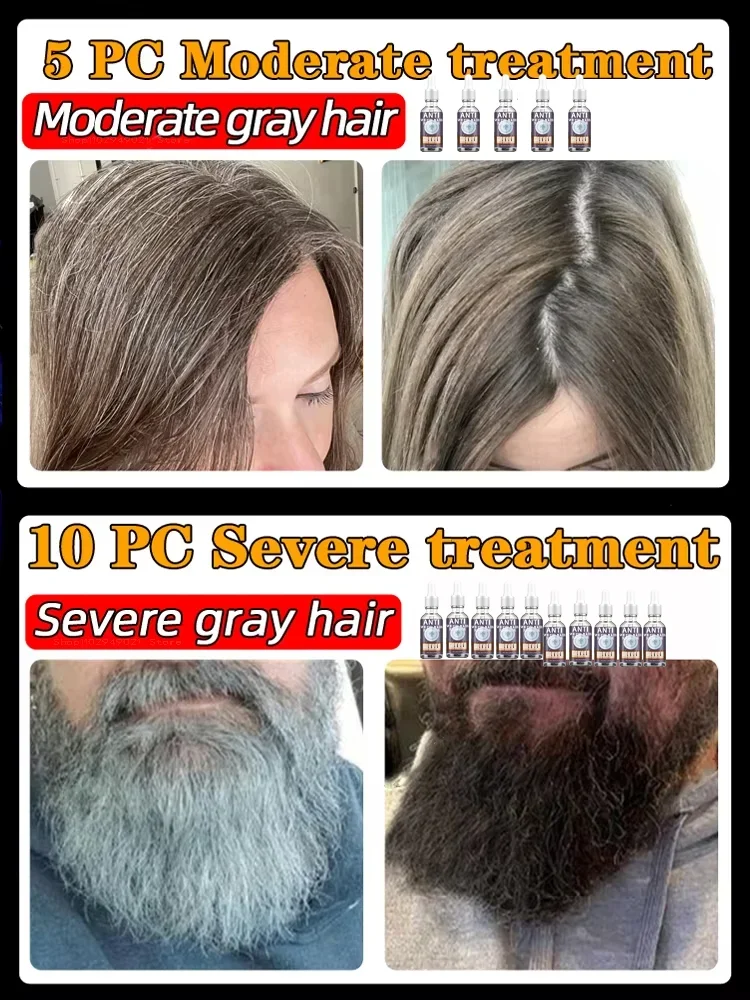يزيل جوهر المضاد للتبييض الطبيعي النقي يزيل الشعر الرمادي ويحول الشعر الأسود من الجذور #3
