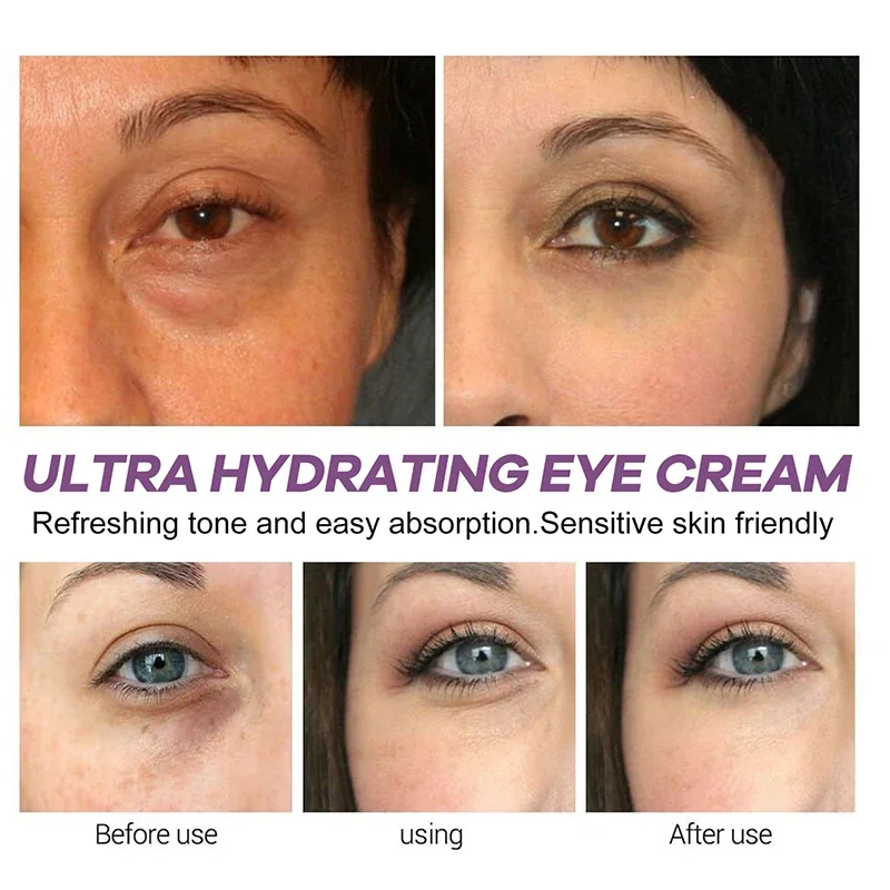 Instant Eye Bag Removal Cream Retinol Anti-Wrinkle Firming Skin Fade Fine Lines Anti Dark Circle Puffiness Brighten Eye Care