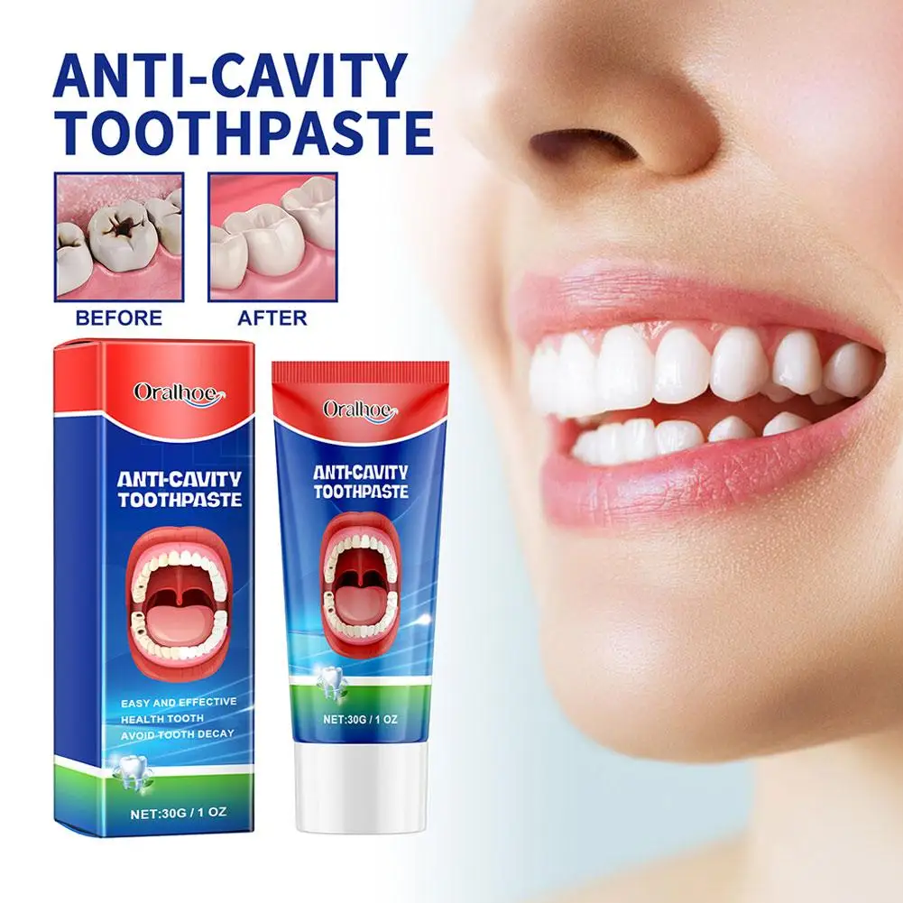 2PCS Anti Decay Toothpaste Dental Caries Repair Cream Decay Protect Teeth Remove Plaque Toothache Relieve Periodontitis