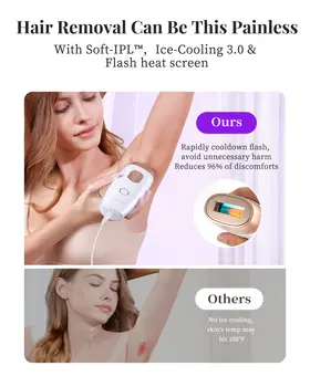 8 best sales IPL 피부 재생 - №6