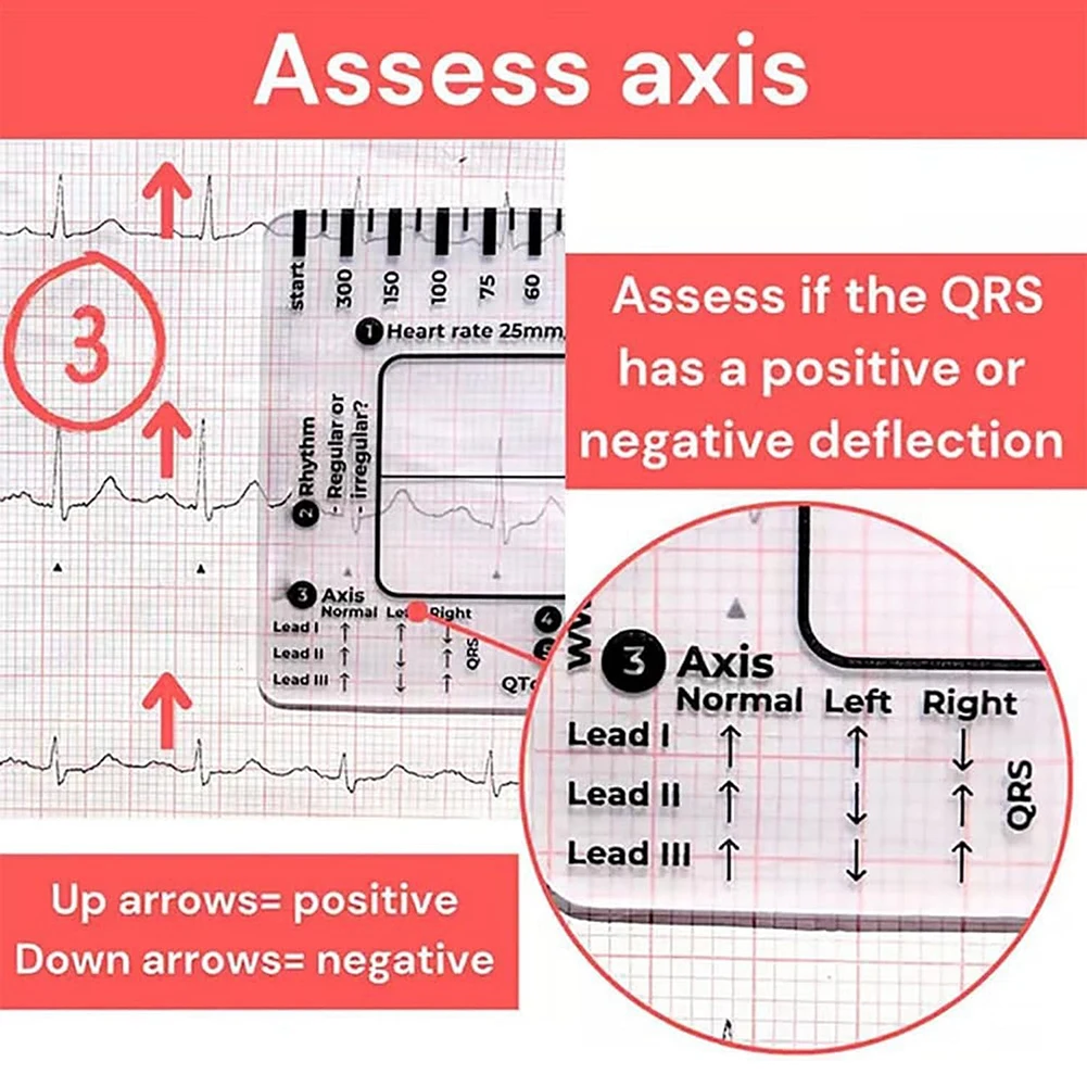 Electrocardiogram 7 Step Ruler Transparent EKG Calipers Measuring Portable Pocket ECG Nurse Easy Carry Ruler EKG Interpretation