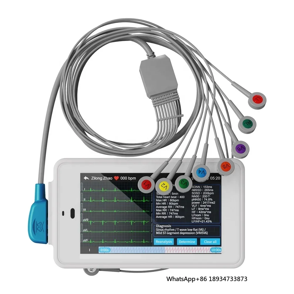 Wellue PCECG 500 24 Hours 12 Channel Portable ECG Machine 12 Leads Electrocardiograph ECG