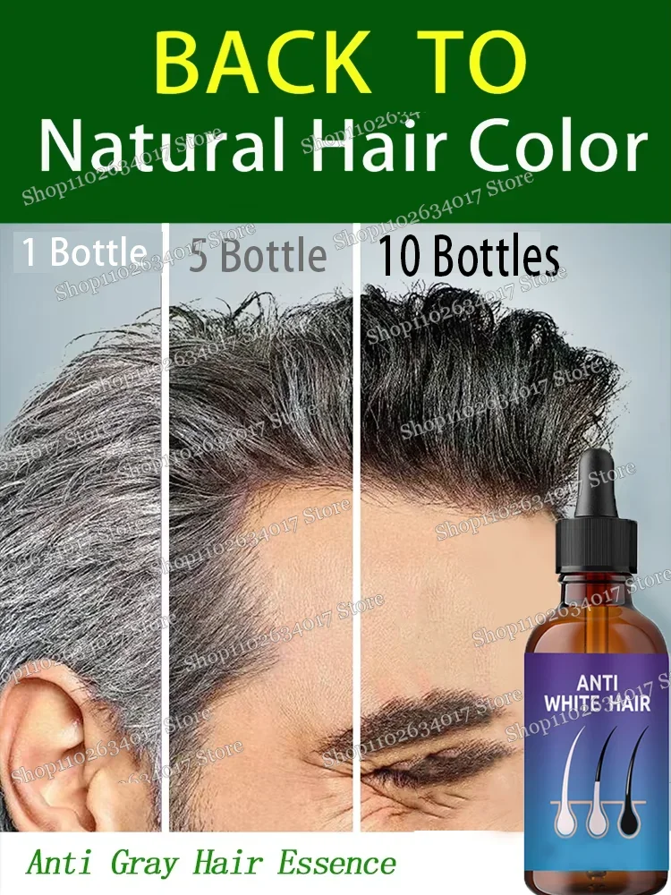 Natural and Healthy White To Black hair No hair color,no allergies Anti-grey quickly turns white hair into black repairs natural