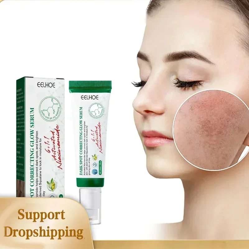 Dark Spot Removal Serum Remove Melasma Fade Pigmentation Brighter Chloasma Sun Spot Remover Anti Aging Whitening Sprout Cream