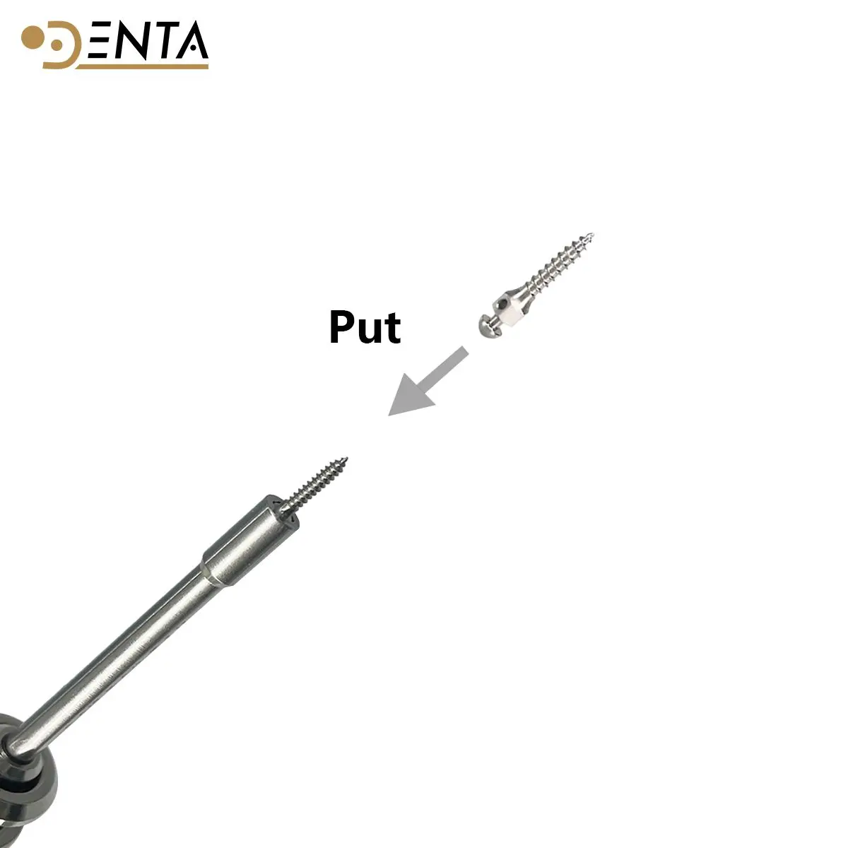 

5pcs Dental Orthodontic Mini Implant Micro Screws Titanium Alloy Implant Screwdriver Screw snail 1.4/1.6/1.8/2.0mm x 6/8/10/12mm