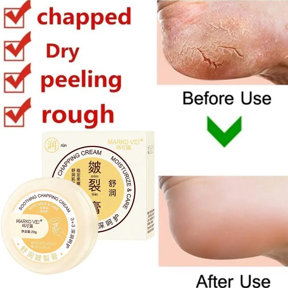 Anti Crack Foot Cream 20g Winter Moisturizing Repair Skin Concentrated Smooths Removal Dead Skin Foot Care Effective Cream