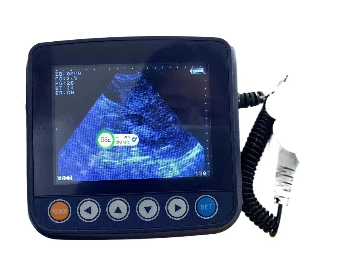 CHKJ 2025 806F الماسح الضوئي بالموجات فوق الصوتية لآلة الموجات فوق الصوتية