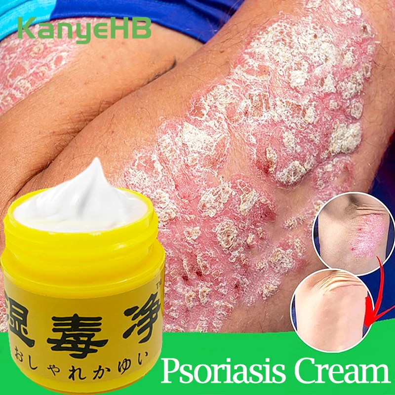 

1/3/5Pcs Against Psoriasis Treatment Cream Inhibit Fungi Dermatitis Eczema Skin Rash Urticaria Desquamation Skin Care Ointment