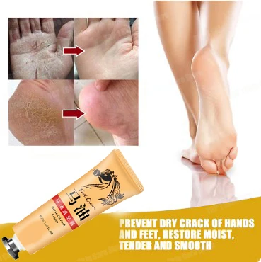 Horse Oil Skin Cream Anti-cracking Ointment Prevents Dry Skin Moisturizes Protects Fingers Feet And Skin Care Products