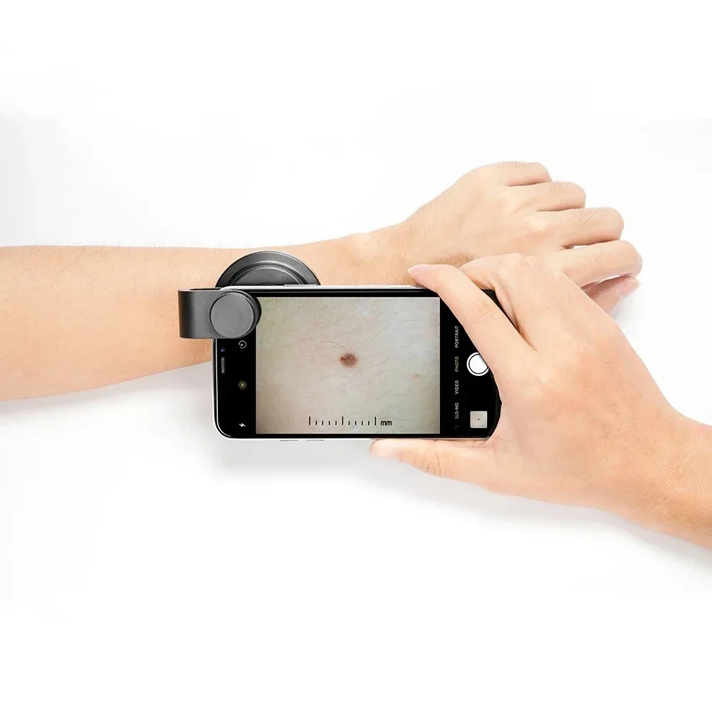 

DE-400 Polarized Optical 10X Skin Magnifier Smartphone Dermatoscope Pocket round Dermoscopy for Home Use