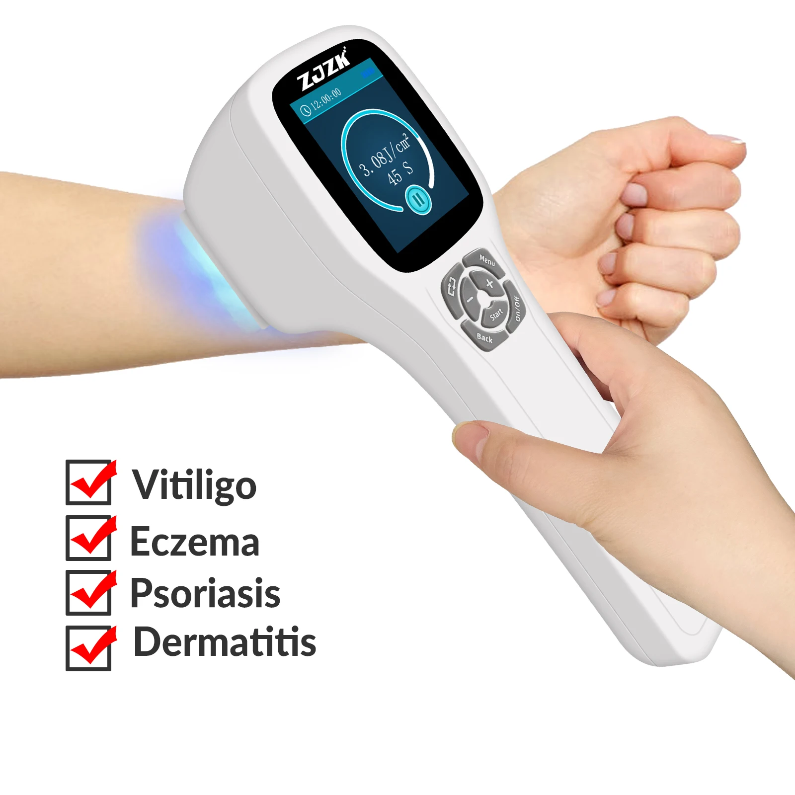 ZJZK 450mW Household UVB Phototherapy 308nmx64diodes UV Light Treatment For Skin Psoriasis Pustulosis Palmaris And Plantaris