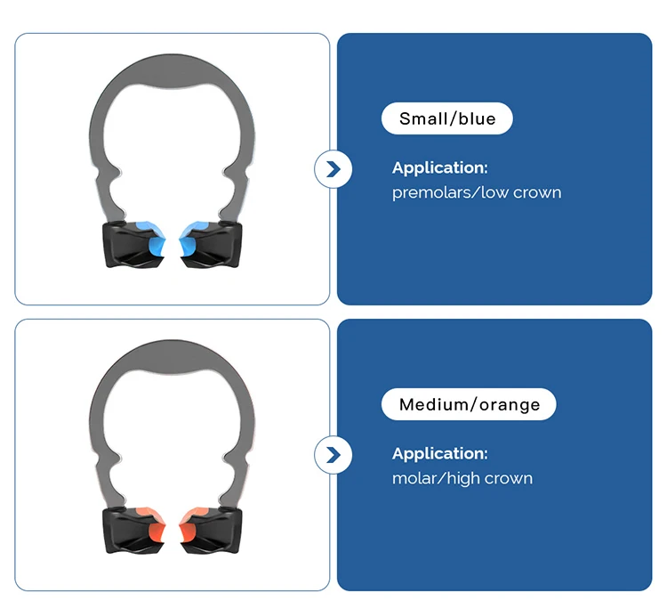 Dental Schnitt Matrix System Set Konturierte Matrizen Clip Ring Matrix Bands Keil Messer Dental Keile Kunststoff Kit Zahnarzt Werkzeuge – Detail 3