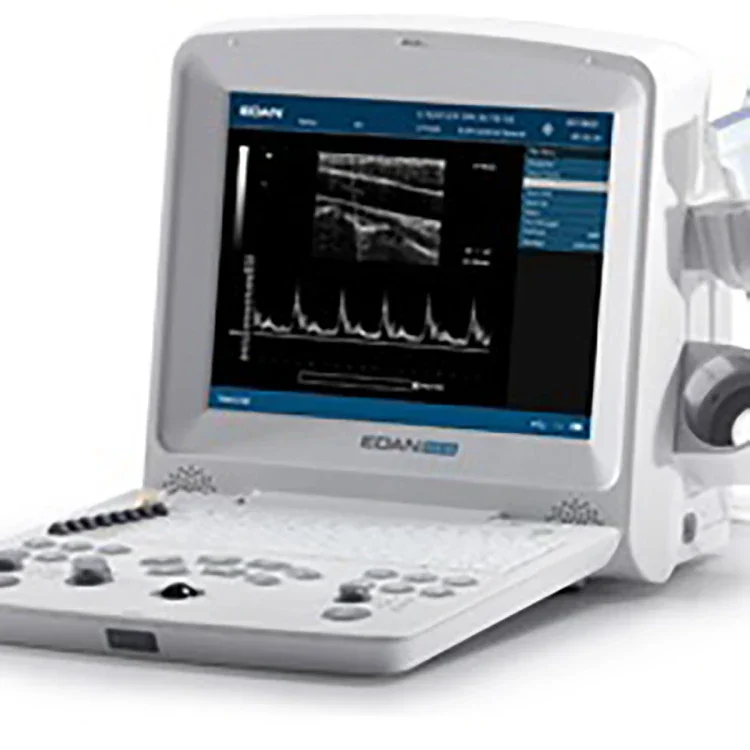 Stock ! ! !  Veterinary portable ultrasound edan ultrasound machine dus 60 dus60