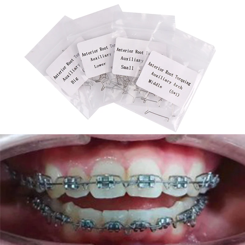 Torque de raiz anterior dental, arco auxiliar, ortodôntico pequeno, médio, grande, 5pcs