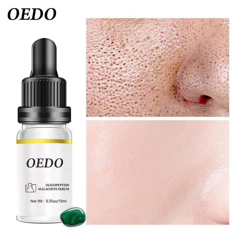 

OEDO Oligopeptide Malachite Serum moisturizes skin Moisturizing Anti-Aging Improve facial fine lin nourishes skin care 10ml