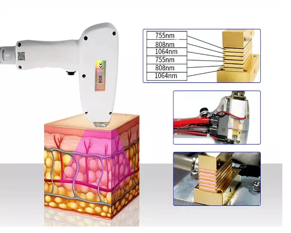 Professional 808nm Diode Laser Hair Removal Machine fast painless air cooling permanent lazer hair removal 3 wavelength 755nm