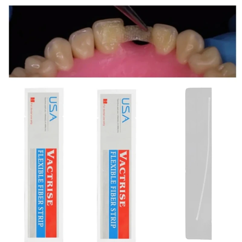 Tira de fibra Flexible de Material Dental, férula de vidrio, tiras de fijación de dientes sueltos, retenedores de ortodoncia de unión de curado ligero, 1 Uds.