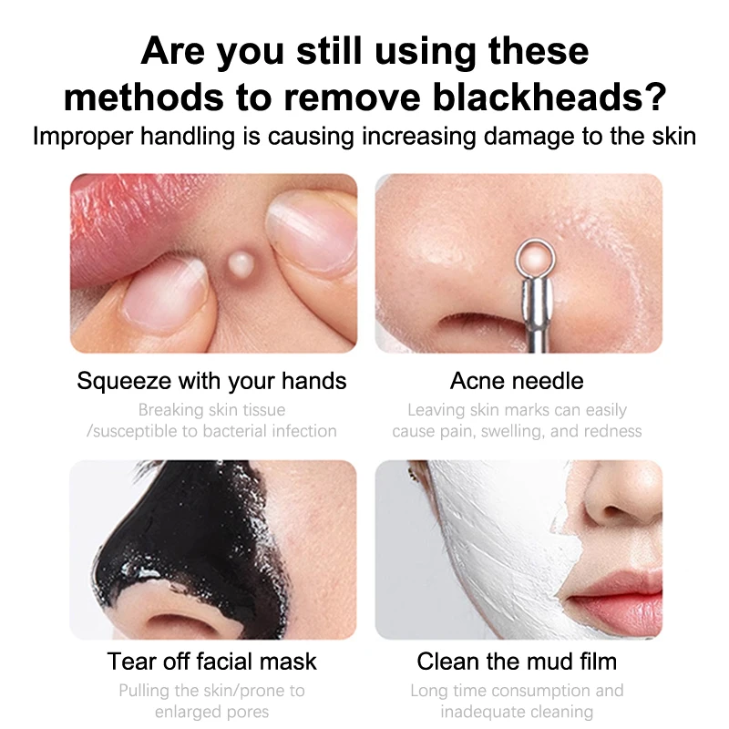 Nova pá de cravo manual remoção cravo silicone rosto escova cabeça acne poros limpeza instrumento beleza ferramentas