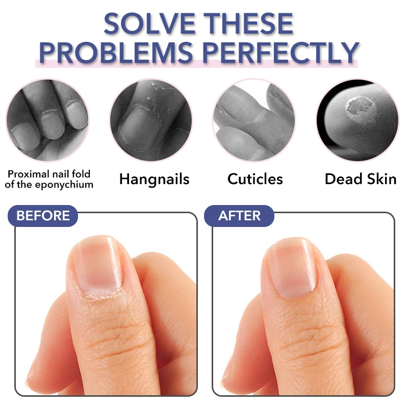 Pinza para cutículas de acero inoxidable, tijeras profesionales para quitar los dedos, cortaúñas para manicura, herramientas para la piel muerta, color dorado