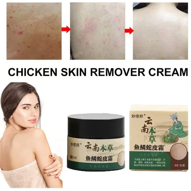 

Curing Keratosis Pilaris Chicken Follicle Skin Repair Cream Body Dark Spot Remove Whiten Smooth Moisturize Skincare Body Lotion