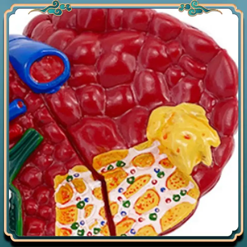 

(New)-Pathological Liver Model For Common Pathologies, Liver Model Human Anatomy Office Anatomy Model