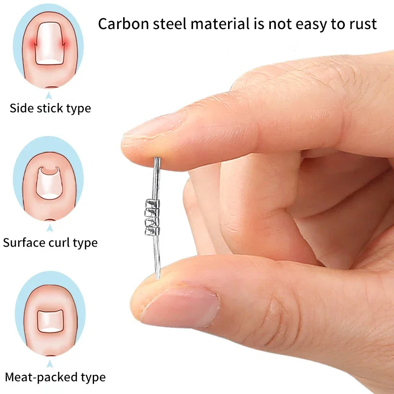 Herramienta de corrección de uñas encarnadas invisibles, Clip alisador elástico, soporte para pedicura, cuidado de uñas, 1 Uds.